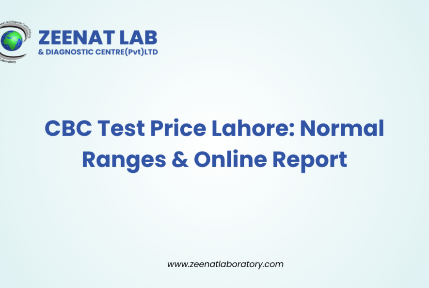 CBC Test Price Lahore